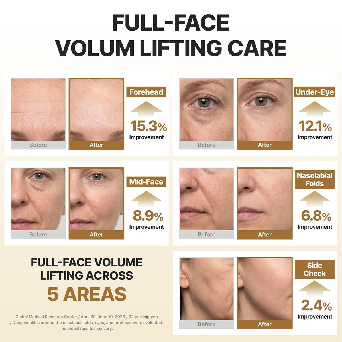 Centellian24 Expert Madeca Cream Core Voluming Volufiline 5% 50ml