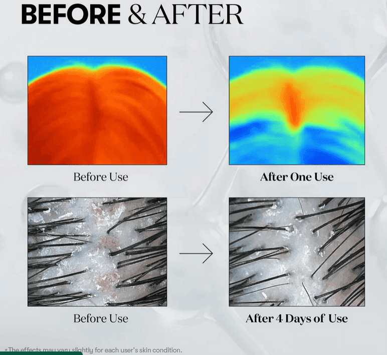 VT Cosmetics PDRN Reedle Shot Hair Ampoule 100dL - Kbeauty.sale