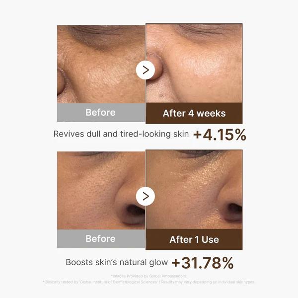 Medicube Deep Vita C Capsule Serum 30ml