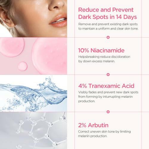 KBeauty Sale | Authentic Korean Skincare Products Ships from USA Anua Dark Spot Correcting Serum / 10% Niacinamide+ 4% Tranexamic Acid, for Post-Acne Marks, Acne Scars, Hyperpigmentation and Even Skin Tone, Fragrance-Free (30ml /1.01 fl.oz.).